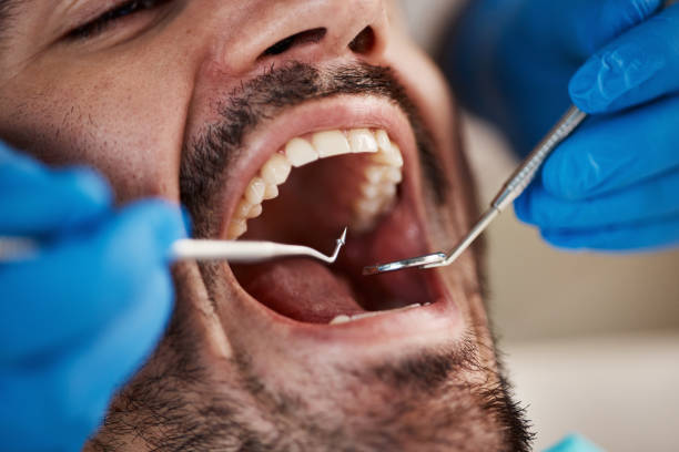 Best Emergency Dentist for Lost Fillings or Crowns in Waterloo, IN