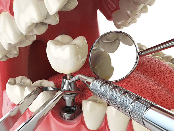 Best Holiday Emergency Dentist in Waterloo, IN